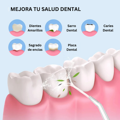 Jet-White™ - Irrigador oral antisarro recargable